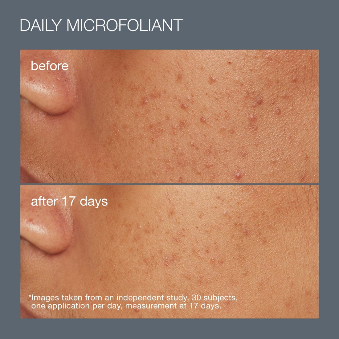 best cleanse + glow set (3 full-size)