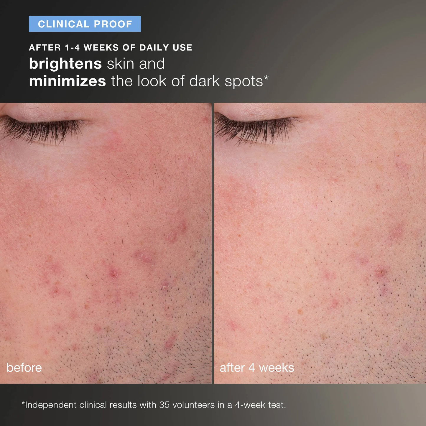 daily microfoliant