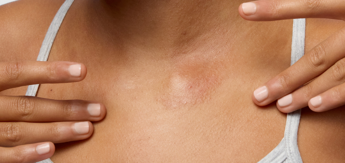 what is sensory irritation? understanding the difference between sensitive, reactive, and sensitised skin