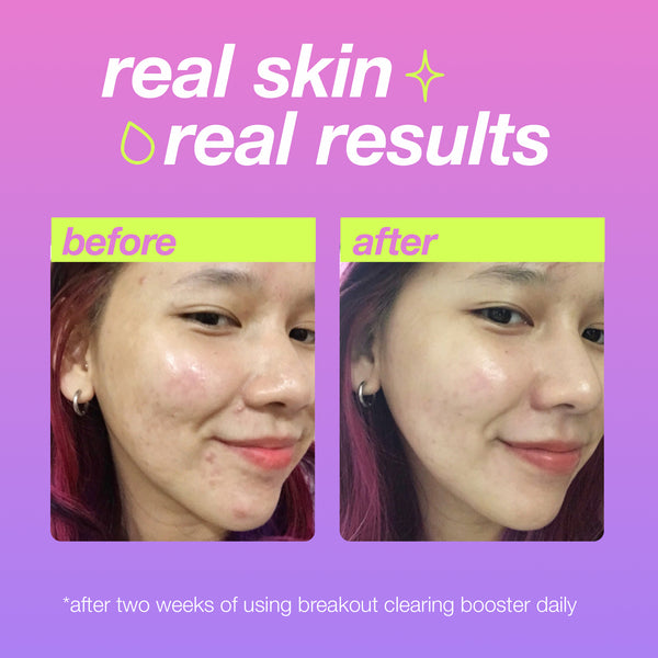 breakout clearing booster