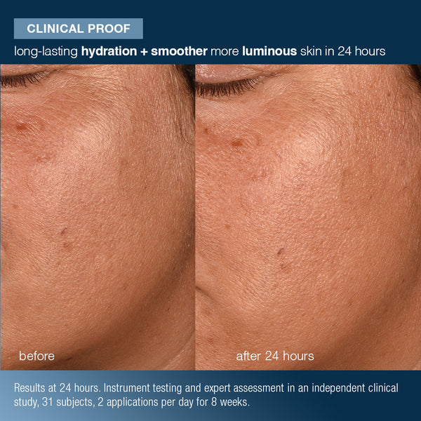 Side-by-side close-ups of a cheek show 24-hour results: smoother, more hydrated skin after using Dermalogica South Africa’s pro-collagen banking water cream with peptide complex for visible anti-aging benefits.