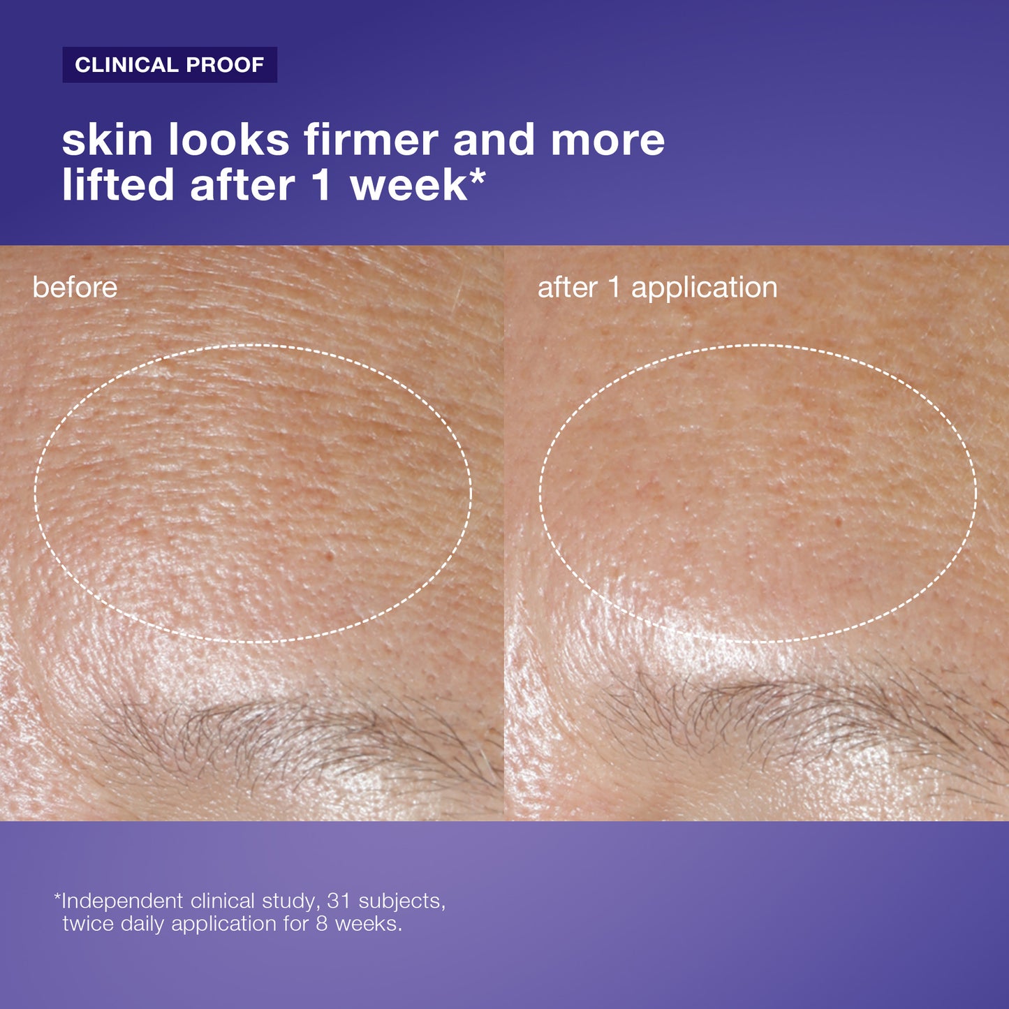 Close-up comparison of forehead skin before and after using Dermalogica phyto nature oxygen cream, showing noticeably smoother and firmer texture in the after image. Text states visible improvement is achieved in one week.