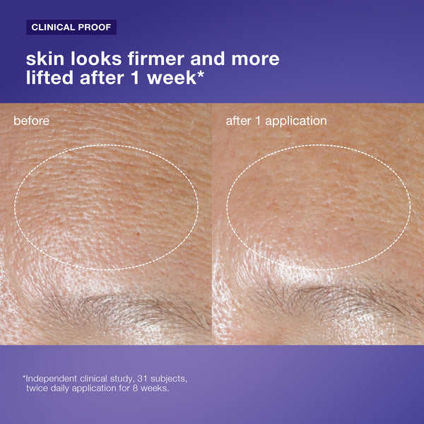 Close-up comparison of forehead skin before and after using Dermalogica phyto nature oxygen cream, showing noticeably smoother and firmer texture in the after image. Text states visible improvement is achieved in one week.