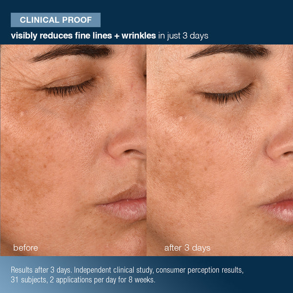 Close-up of a person's cheek and eye area, showing a before image with fine lines and wrinkles, and an after 3 days image with smoother, youthful skin. Text highlights clinical proof of anti-aging results from Dermalogica South Africa's pro-collagen banking water cream.