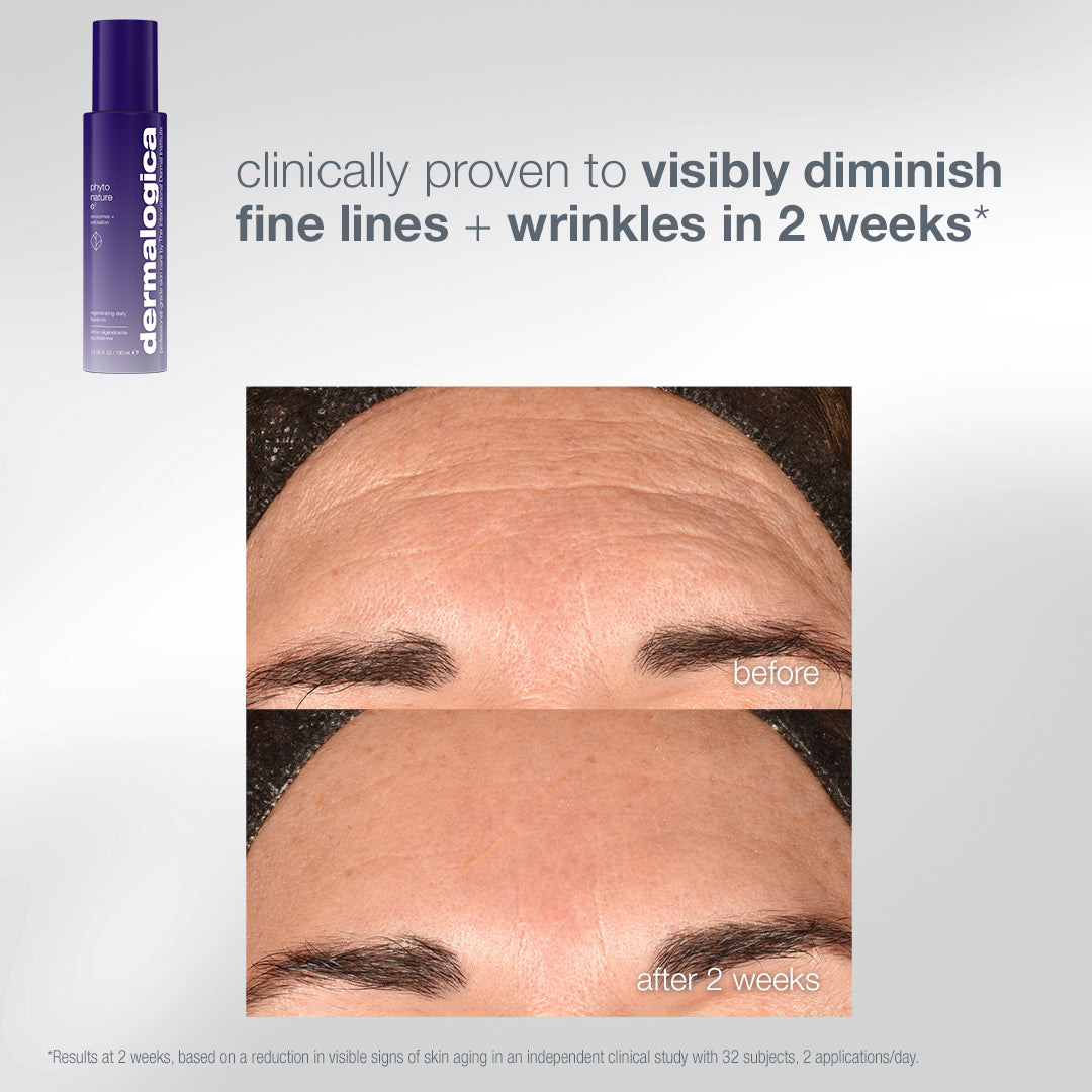 A Dermalogica South Africa the expert lift set serum bottle next to a before-and-after comparison of a forehead showing a reduction in fine lines after two weeks, demonstrating its lift and firm effect on skin aging.