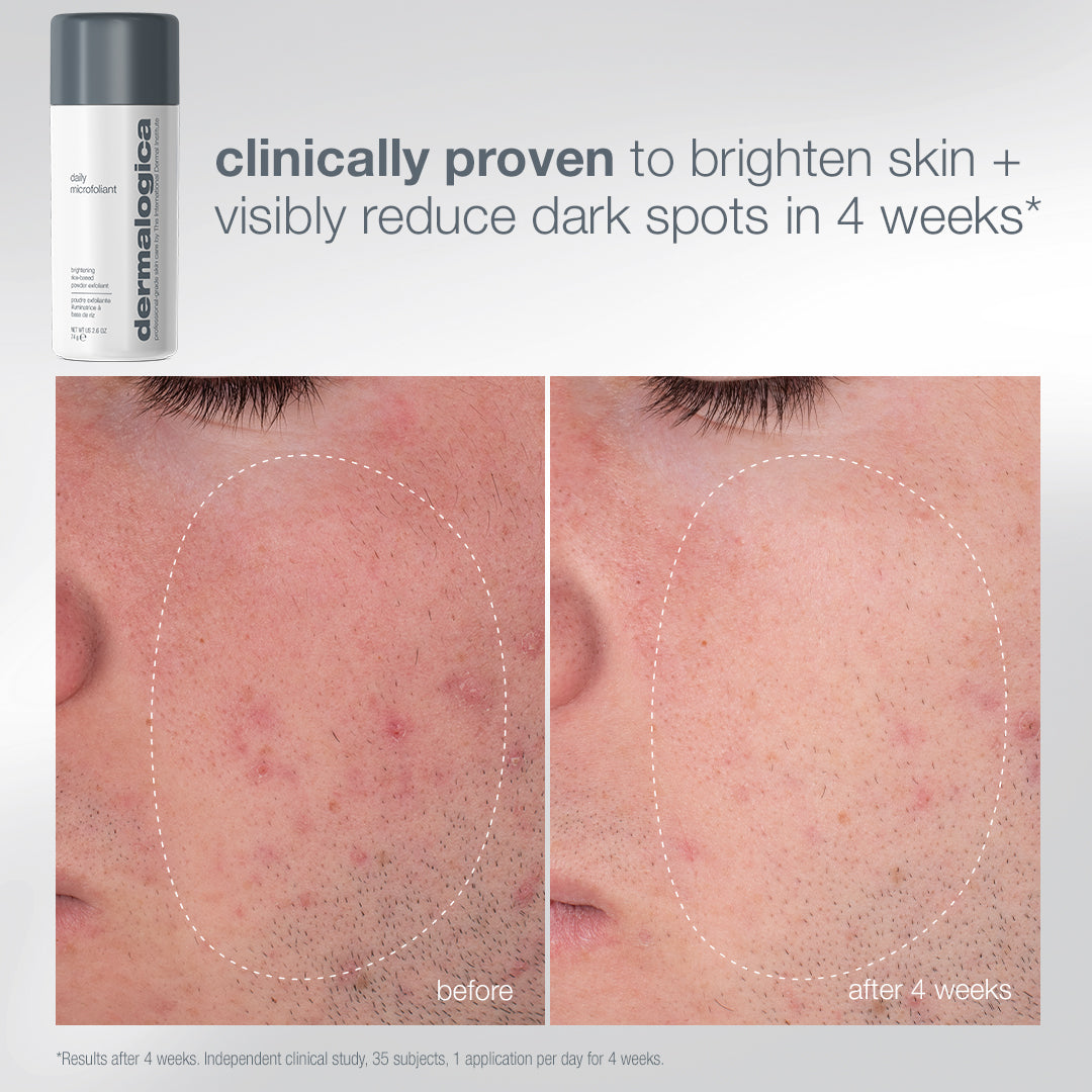 A canister of Dermalogica South Africa expert cleanse + glow set brightening powder exfoliant next to before-and-after close-ups of a cheek showing a reduction in dark spots and redness after four weeks of use.