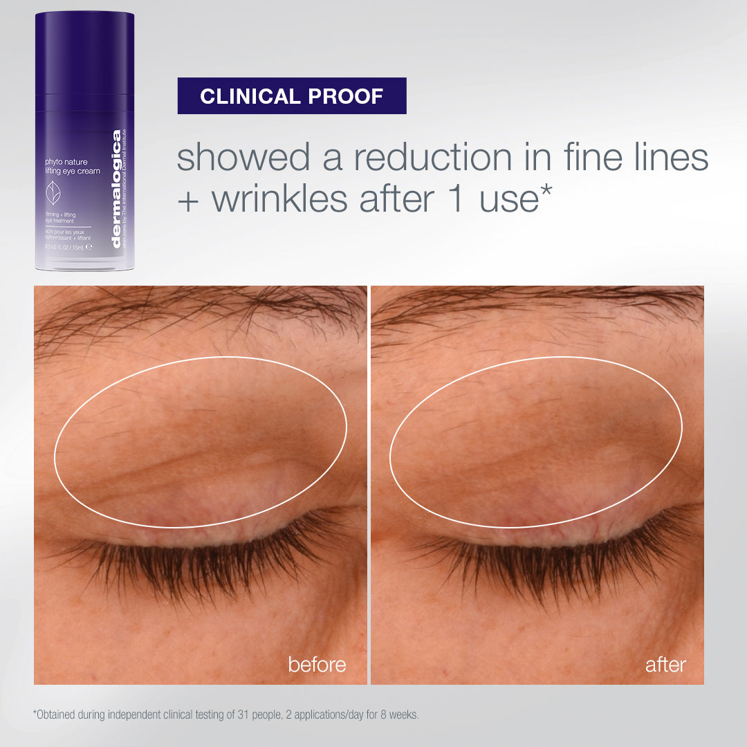 A tube of Dermalogica South Africa the expert lift set (3 full-size) eye cream next to a before-and-after comparison of an eyelid, showing a reduction in fine lines after one use.