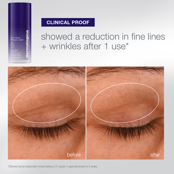 A tube of Dermalogica South Africa the expert lift set (3 full-size) eye cream next to a before-and-after comparison of an eyelid, showing a reduction in fine lines after one use.