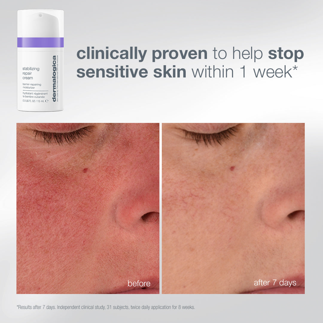 A tube of Dermalogica South Africa expert barrier repair set (3 travel-size) Stabilizing Repair Cream next to before and after close-up photos of skin showing a reduction in redness after seven days.