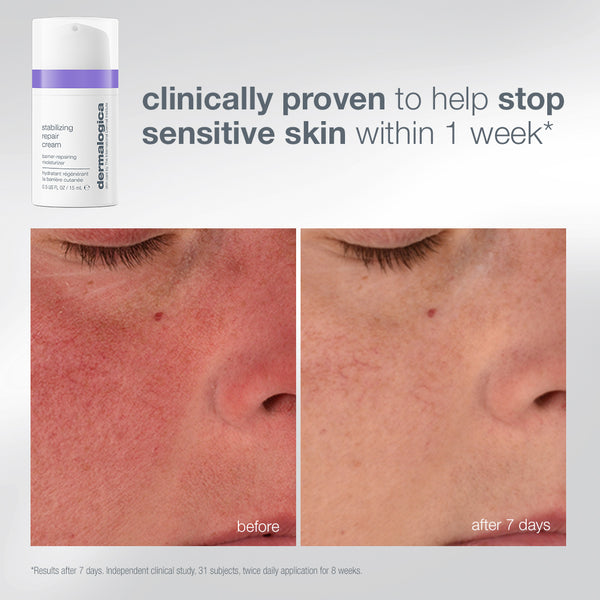 A tube of Dermalogica South Africa expert barrier repair set (3 travel-size) Stabilizing Repair Cream next to before and after close-up photos of skin showing a reduction in redness after seven days.