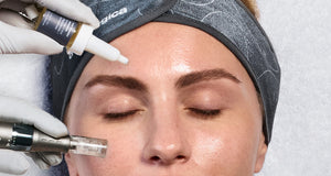 exo booster x microneedling