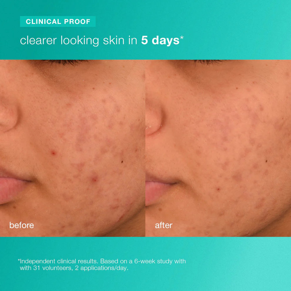 breakout biotic moisturiser