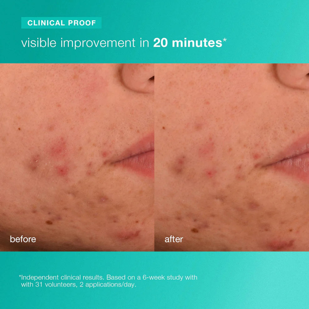 breakout biotic moisturiser