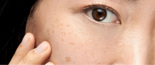 behind the brown spot