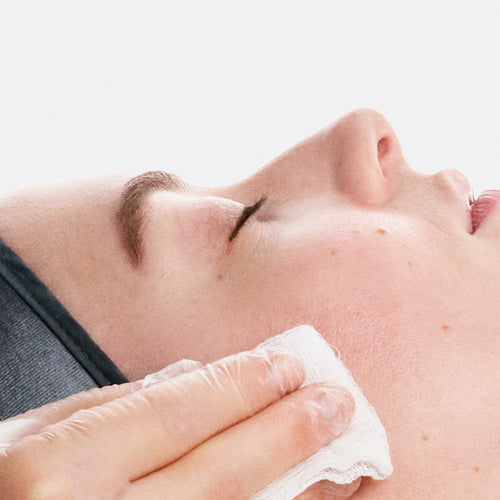 A person with closed eyes relaxes after a Dermalogica pro power peel treatment, while a hand gently wipes their cheek with a soft cloth. They wear a dark headband, and their skin looks smooth and refreshed.