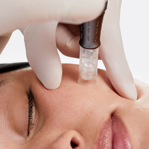 A close-up of a person receiving Dermalogica’s pro microneedling with pro restore treatment, as a gloved hand applies the device to the cheek, helping achieve firmer, tighter skin and a rejuvenated look.