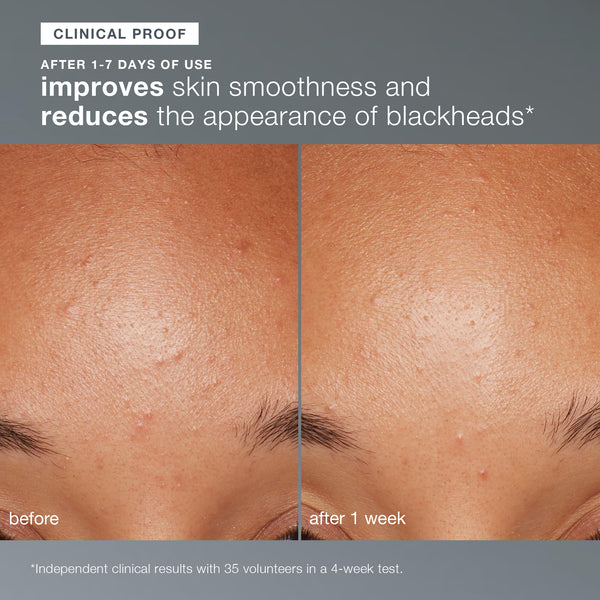 Side-by-side close-ups of a forehead show skin before and after 1 week using Dermalogica daily microfoliant, revealing smoother texture and fewer blackheads. Text highlights clinically proven, visible results.