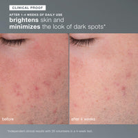 A white and gray Dermalogica daily microfoliant exfoliating powder is pictured with a Best of Beauty Allure 2024 Award Winner seal in the top right corner.