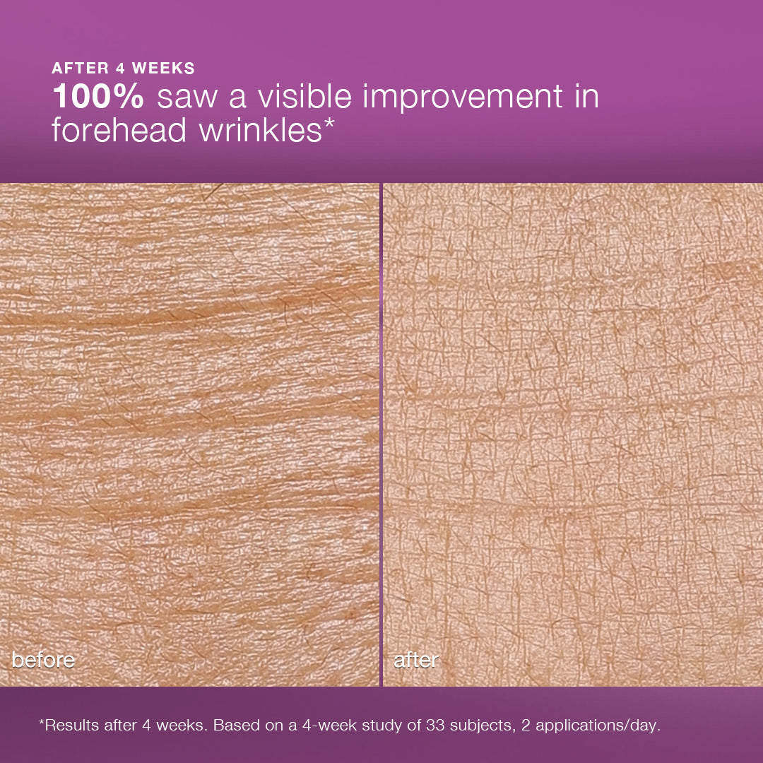 Side-by-side close-ups of forehead skin, labeled before (left, more wrinkles) and after (right, smoother), show 100% saw visible improvement in forehead wrinkles after 4 weeks using Dermalogica South Africa’s multivitamin power recovery cream.
