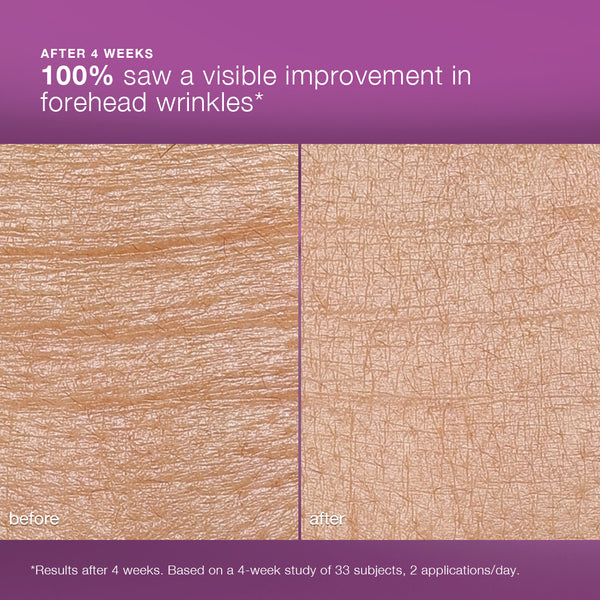 Side-by-side close-ups of forehead skin, labeled before (left, more wrinkles) and after (right, smoother), show 100% saw visible improvement in forehead wrinkles after 4 weeks using Dermalogica South Africa’s multivitamin power recovery cream.