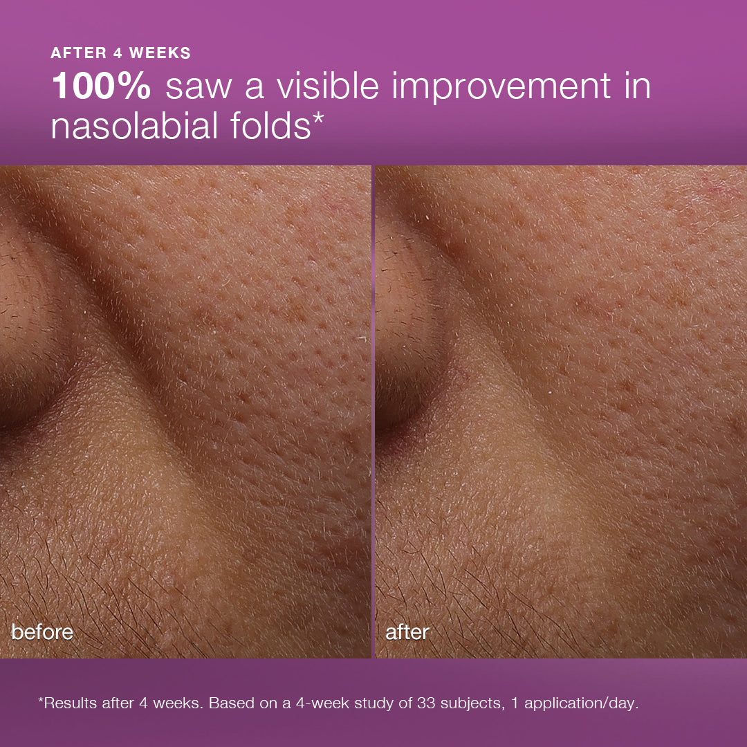 Close-up before-and-after photos show visible improvement in nasolabial folds near the nose after 4 weeks using Dermalogica South Africa multivitamin power recovery cream. 100% of users saw visible improvement in nasolabial folds.