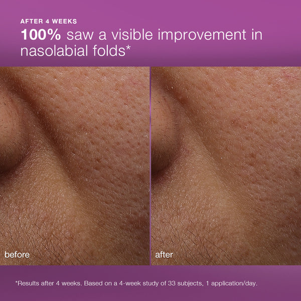 Close-up before-and-after photos show visible improvement in nasolabial folds near the nose after 4 weeks using Dermalogica South Africa multivitamin power recovery cream. 100% of users saw visible improvement in nasolabial folds.