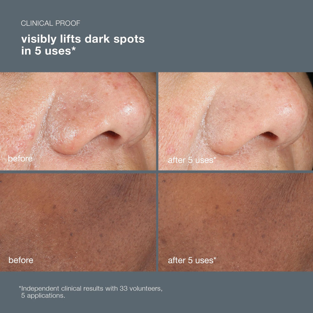 powerbright dark spot peel 50ml