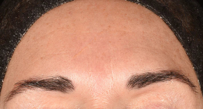 Close-up of a persons forehead and eyebrows, with dark, well-groomed eyebrows and a headband holding the hair back. The skin appears smooth with some visible pores and a faint horizontal line across the forehead.