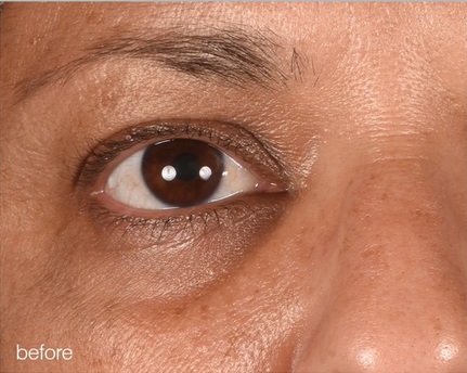 Skin before use