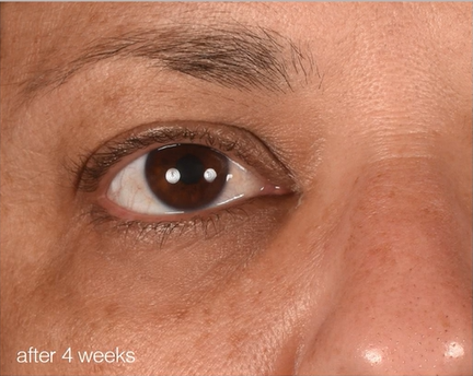 Skin after use