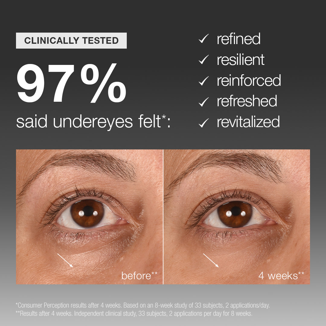 Close-up of a person’s eye area before and after 4 weeks, showing reduced fine lines and wrinkles, diminished dark circles, and smoother skin. Text highlights that 97% felt their under-eye area was refined, resilient, reinforced, refreshed, and revitalized after using Dermalogica South Africa’s smart eye density undereye serum.