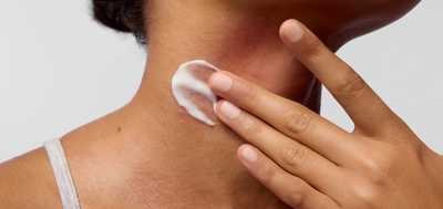 Itchy, stinging, tight skin? here's what your skin is telling you