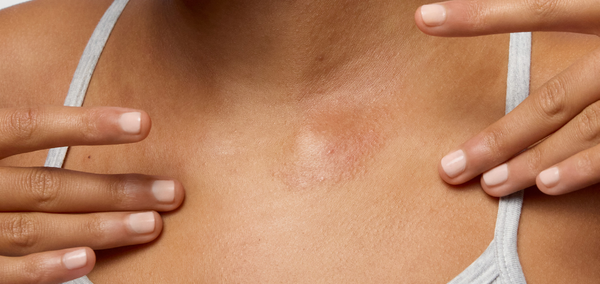what is sensory irritation? understanding the difference between sensitive, reactive, and sensitised skin