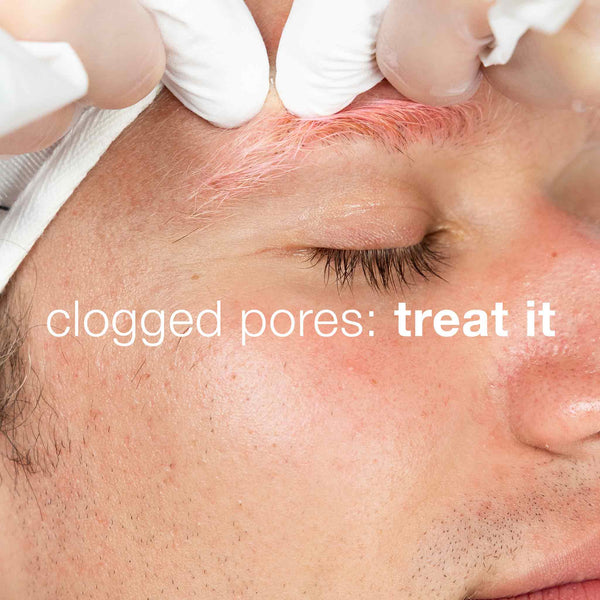 A close-up of a person’s face with eyes closed as gloved hands treat their forehead. The text reads, “clogged pores: treat it.” Reveal clear skin with Dermalogica's active clearing kit—your breakout treatment for refreshed, rejuvenated skin.