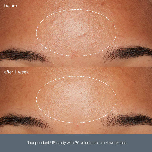 smooth + brighten: daily microfoliant (1 travel size)